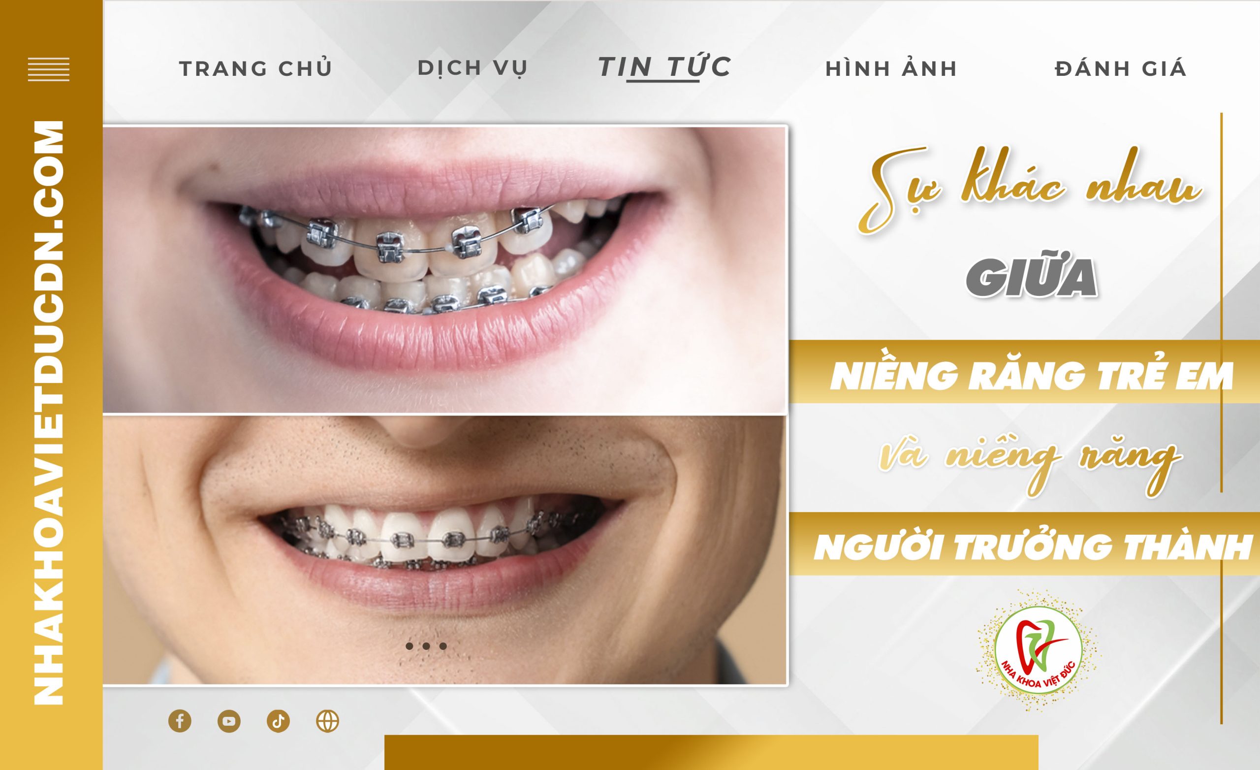 SỰ KHÁC NHAU GIỮA NIỀNG RĂNG TRẺ EM VÀ NIỀNG RĂNG NGƯỜI TRƯỞNG THÀNH