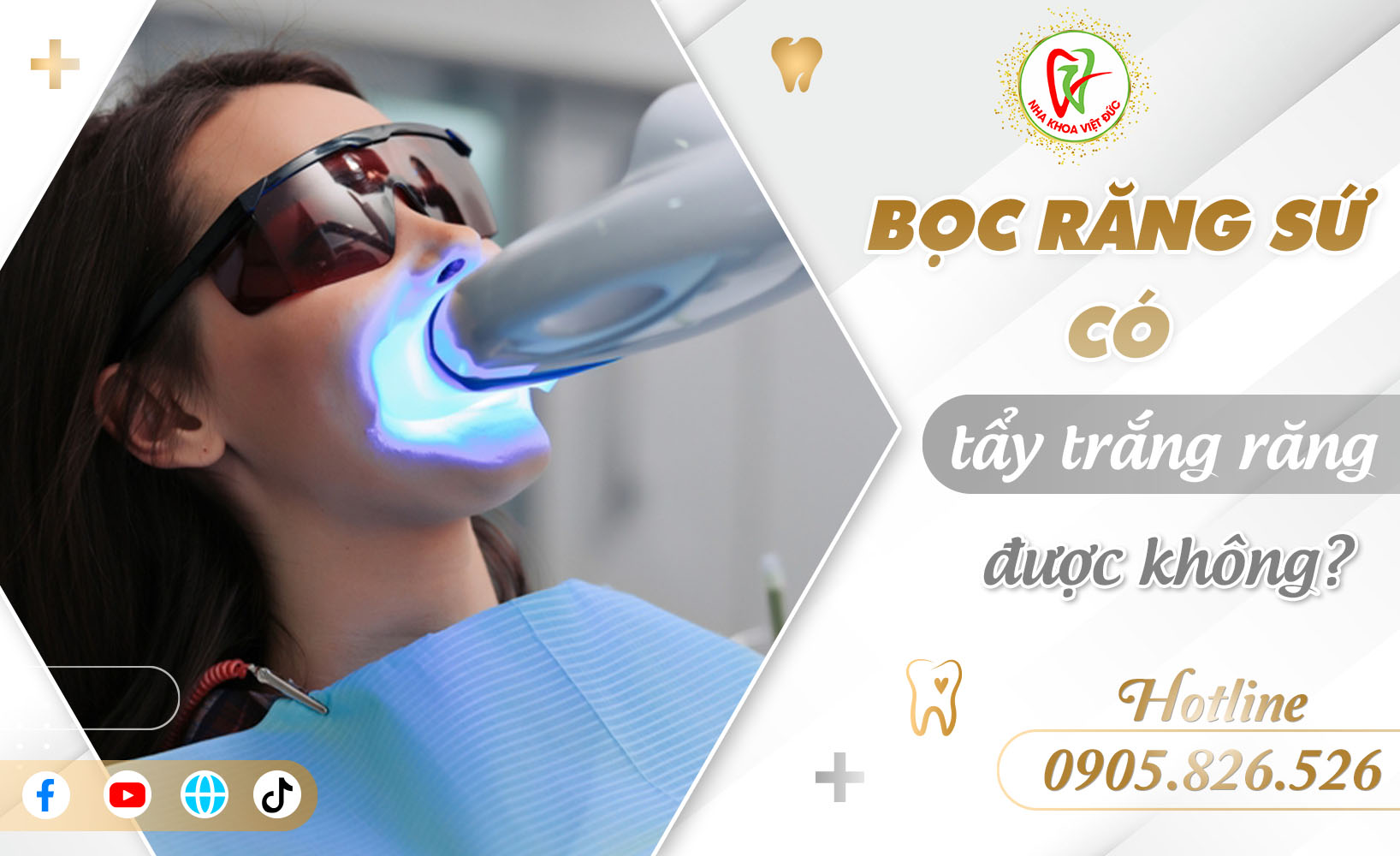 BỌC RĂNG SỨ CÓ TẨY TRẮNG RĂNG ĐƯỢC KHÔNG?